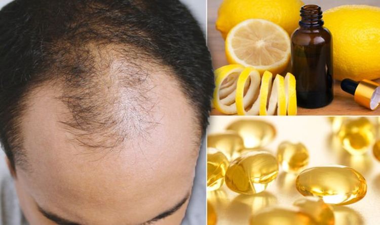 Hair loss treatments: What are the best natural remedies to prevent alopecia symptoms?