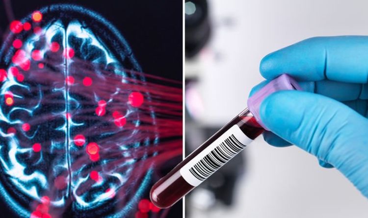 Dementia: New blood test could be a game-changer for treating Alzheimer’s disease