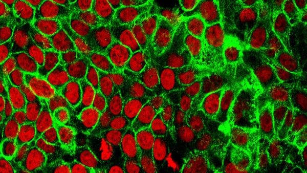 Google’s AI model can help improve neural networks in medical research