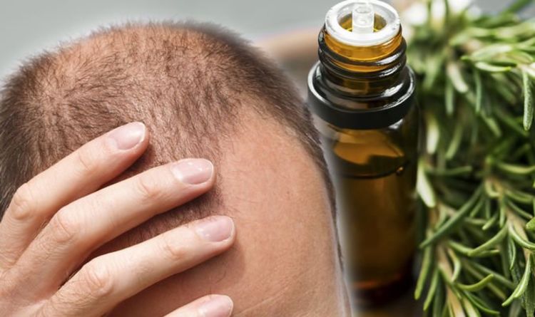 Hair loss treatment: Rosemary oil shown to be just as effective as minoxidil for regrowth