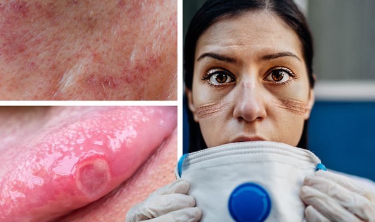 Covid new strain symptoms: One in five now experiencing