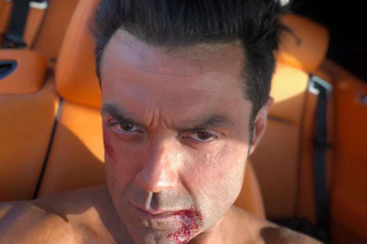 Bobby Deol marks three years of 'Race 3': Can't wait to show you all everything coming up next