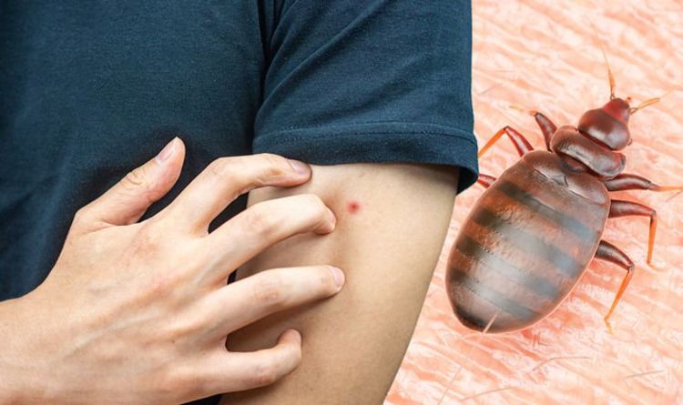 Red spots that become ‘raised’ may signal you’ve been bitten by a bed bug