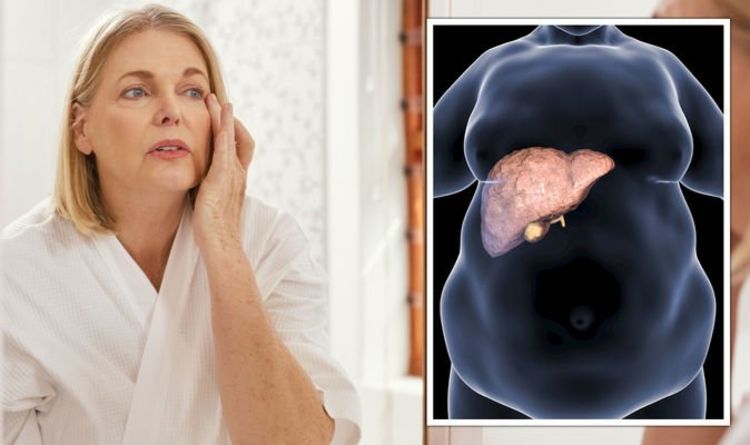 Fatty liver disease: The sign on the surface of the skin indicating ‘serious’ damage