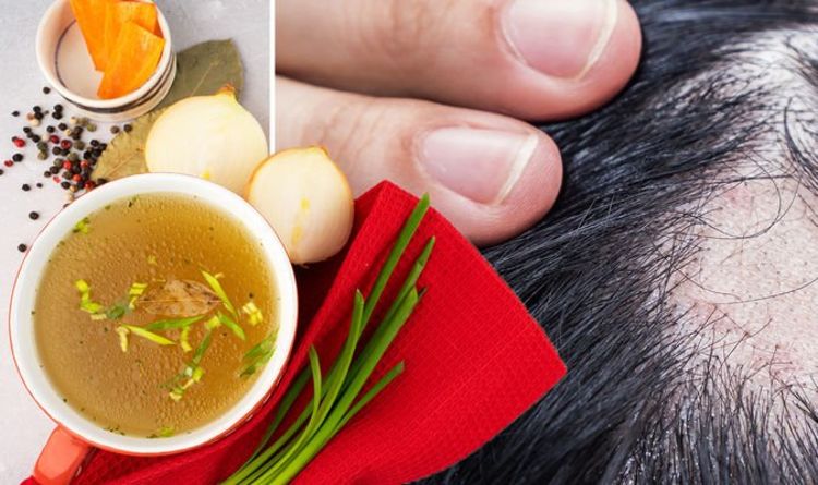 Hair loss treatment: Onion juice promotes hair growth within two weeks