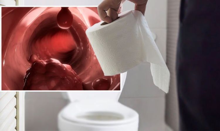 Bowel cancer symptoms: Look at your toilet paper after wiping - it could be a sign