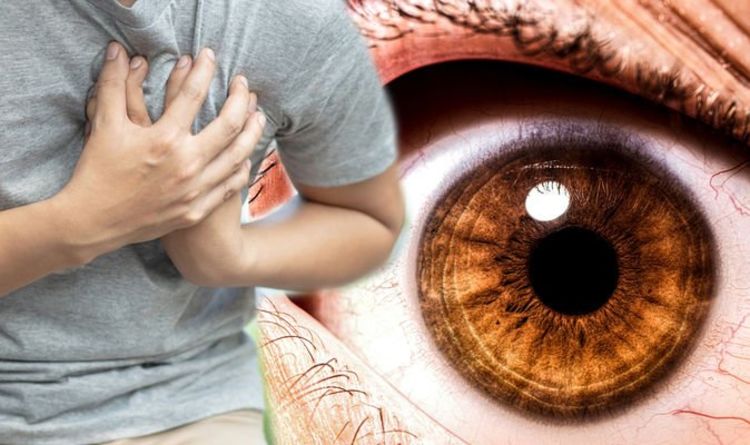 Heart attack: The hidden signs found in your eyes warning of the dangerous condition
