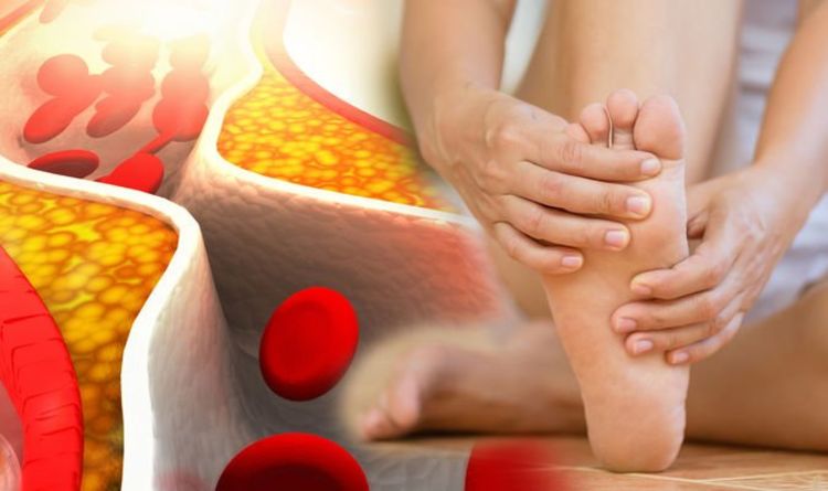 Have you been experiencing cold feet? The lesser-known warning sign of high cholesterol