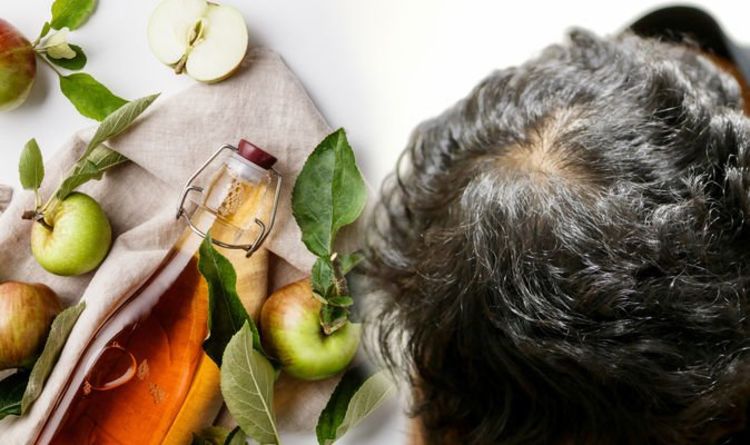 Hair loss treatment: Apple cider vinegar restores the PH balance to increase hair growth
