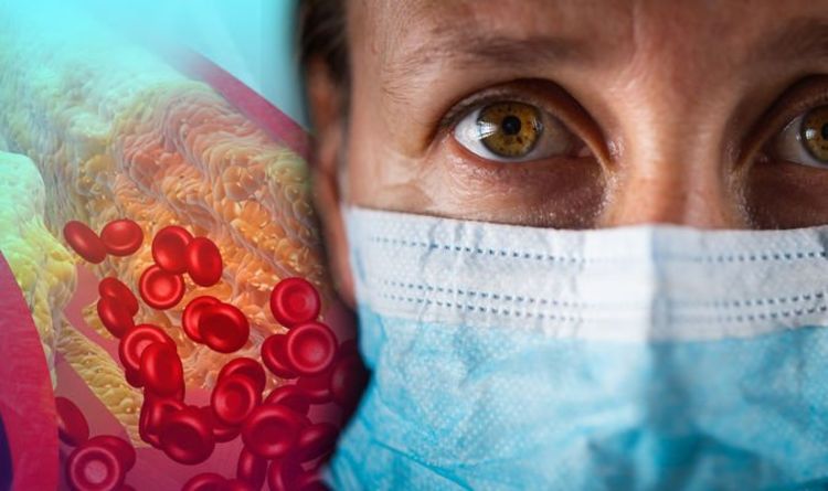 Covid latest: Cholesterol is the key factor for severe covid infections says latest study