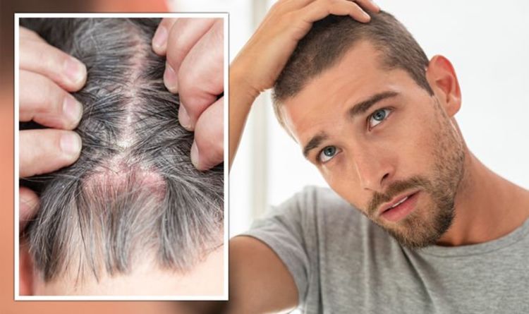 Do you have an itchy scalp? Warning signs that your rash is a ‘contagious’ scalp infection