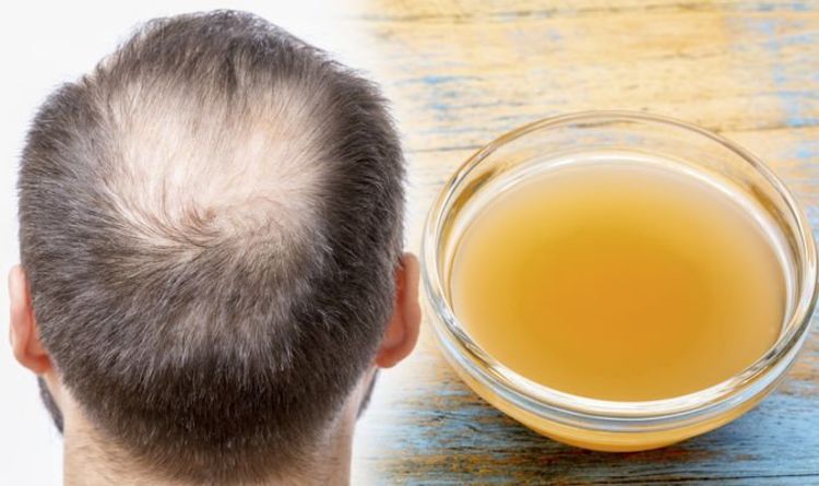 Hair loss treatment: A vinegar which wards off bacteria to help increase hair growth
