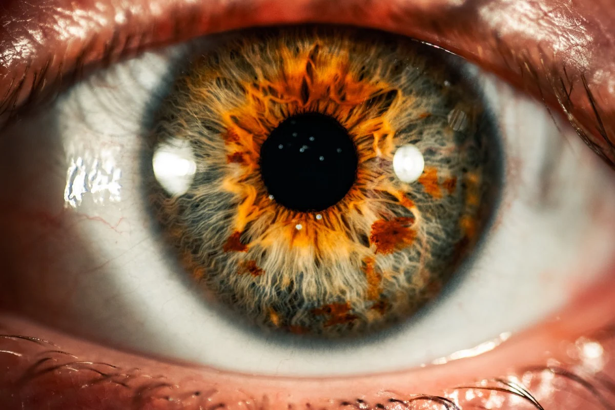 Retina Scan Can Help Distinguish ADHD From ASD, Research Suggests