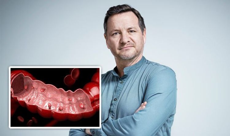 Bowel cancer symptoms: Polyps can develop into the deadly disease - what are they?
