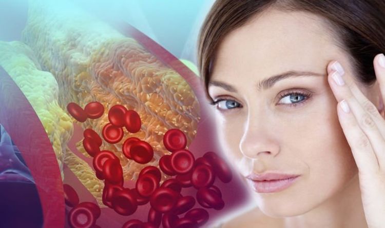 High cholesterol: Lumps and an arc around the iris are two signs found in the eyes