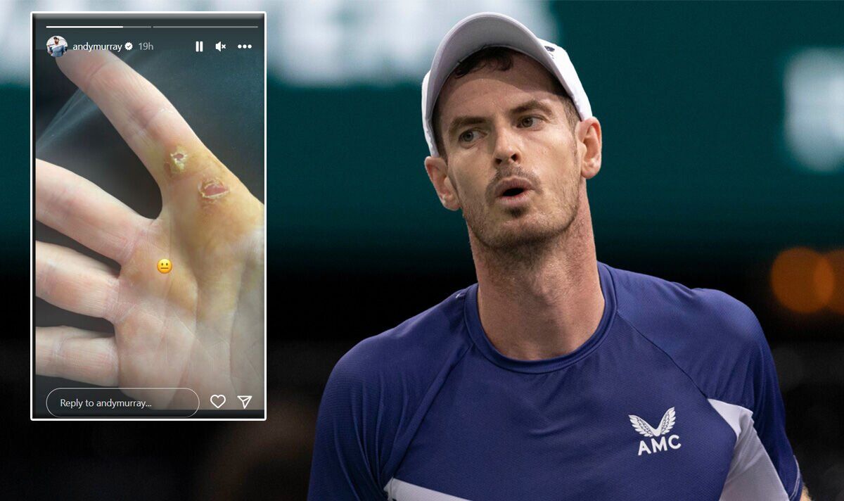 Murray shows off painful new injury which will slow down 2023 plans
