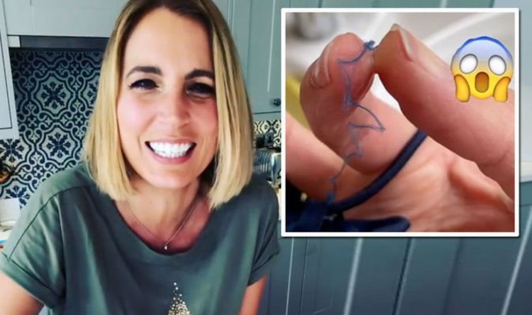 Jasmine Harman: A Place In The Sun presenter accidentally superglues fingers together