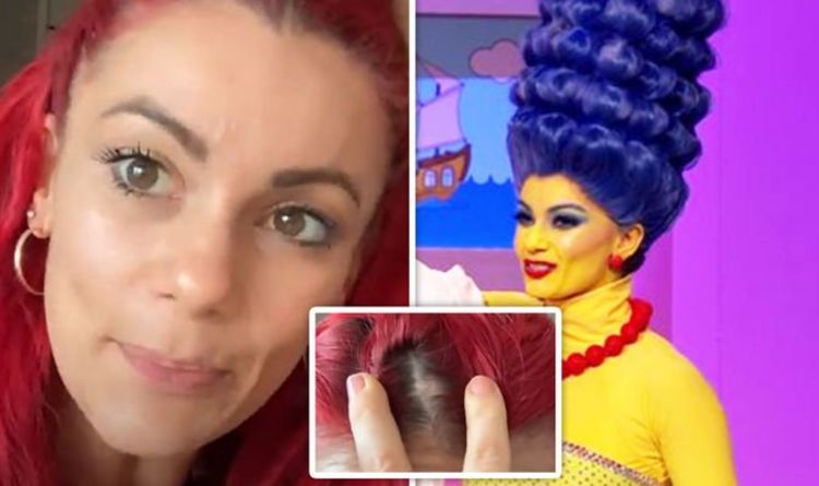 Dianne Buswell shares video of bald patch caused by Marge Simpson costume on Strictly